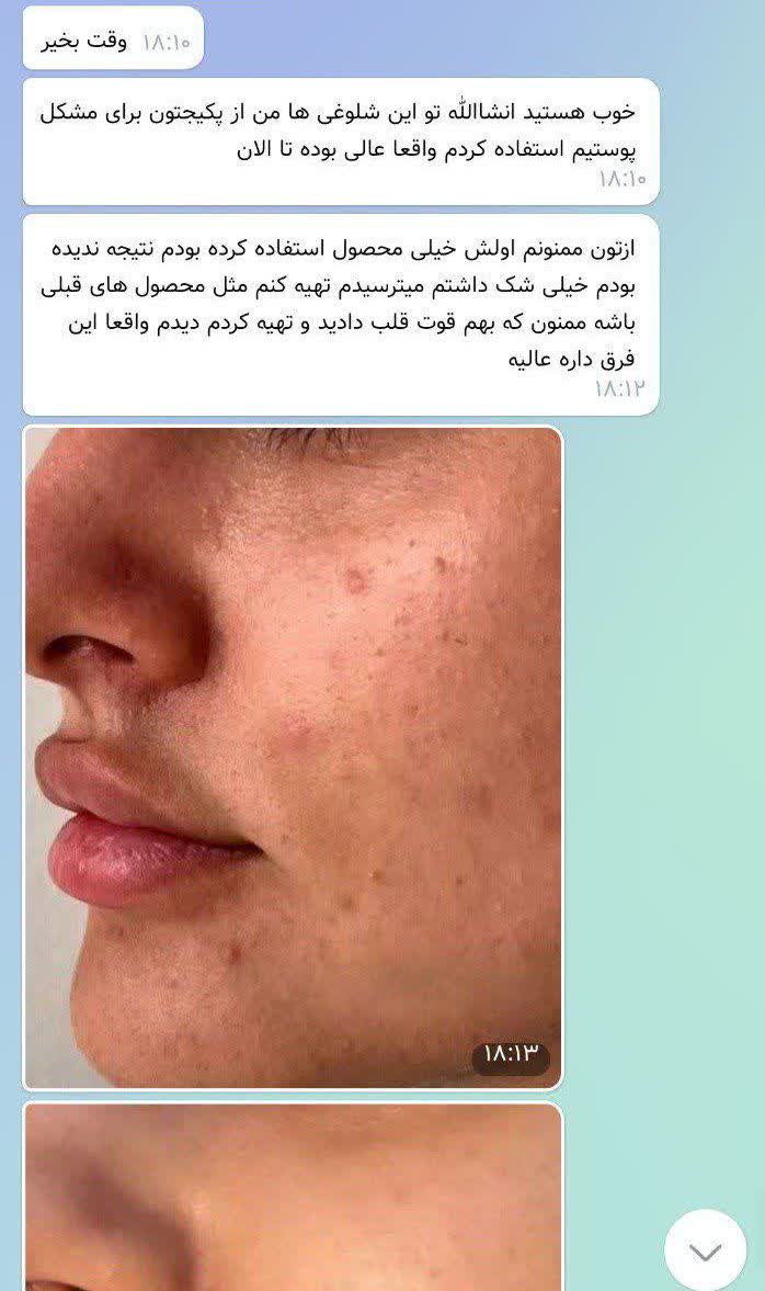 کرم (چندکاره) برند لاکچری کوین پایه اصلی 60 %ضد لک و ضد اکنه/40%ضد چین و چروک-ابرسان-روشن کننده_ رفع منافذ-رفع تیرگی جوانساز ساخت فرانسه مستقیم از نمایندگی ایران زمین تهران