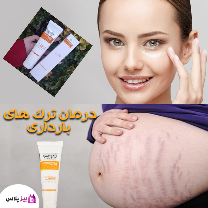 کرم رفع__ترکهای پوستی بیوممتیک ناشی از بارداری گاتیو ایتالیا
